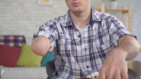 Young man puts on a prosthetic arm Stock Footage 118990512