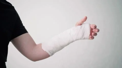 A young man shows the injury of a broken arm in a plaster bandage on a white Видео 132995641