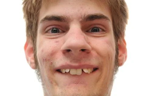 Young man smiling who needs braces Stock Photos