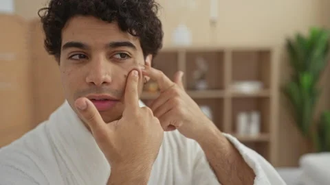 Young man in a spa room squeezing a pimple on his cheek while wearing a whi.. Stock Footage 285095409