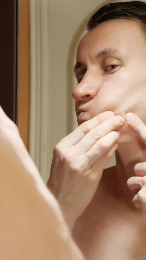 Young man squeezing pimple in mirror, skin care problem and acne treatment Stock Footage 344824133
