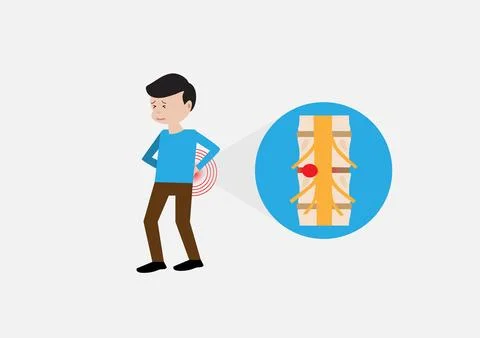 Young man suffering from herniated disc with back pain Stock Illustration