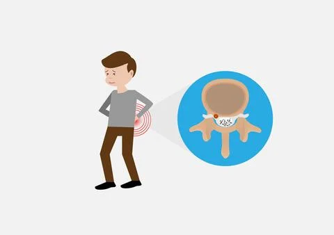 Young man suffering from herniated disc with back pain Stock Illustration