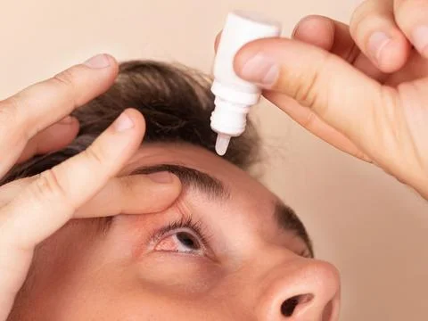 Young man uses eye drops for eye treatment. Redness, Dry Eyes, Allergy and Ey Stock Photos