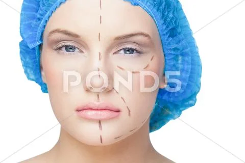 Young patient with dotted lines on the face Stock-Fotos