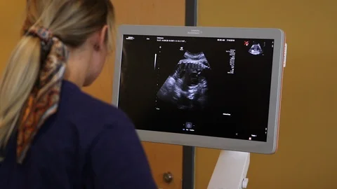 Young sonographer examines image Stock Footage 114181420