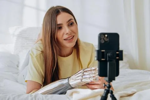 Young woman with a bionic prosthetic arm filming a vlog on a smartphone Stock Photos