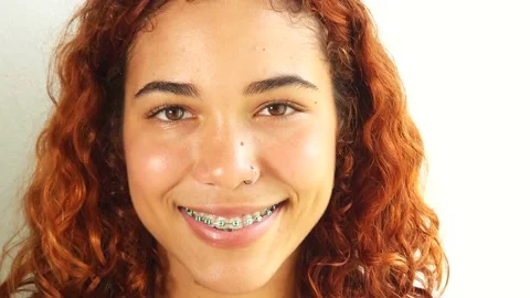 Young Woman with Braces Smiling at Camera Stock Footage 220156817