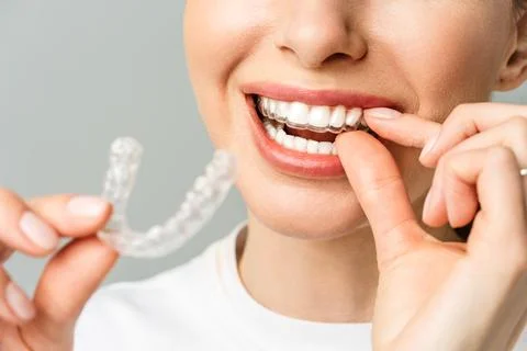 A young woman does a home teeth whitening procedure. Whitening tray with gel Stock Photos