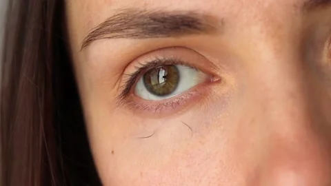 Young woman with eyelash loss problem, eye close-up Stock Footage 201367183
