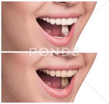 Young Woman With Healthy Smile