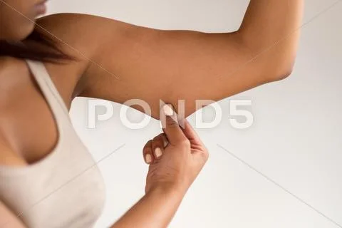 Young Woman Holding Excess Fat on her Arm Stock Photos