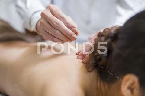 Young Woman Receiving Acupuncture