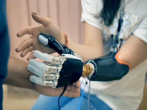 Young woman trying wireless bionic prosthesis. 4K. Stock Footage 80633210