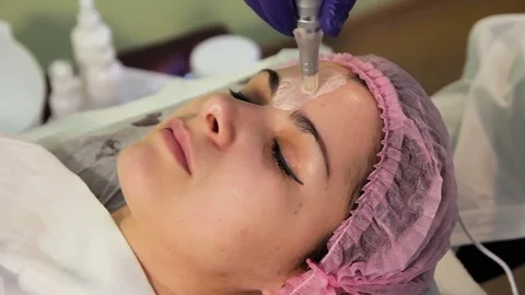 The young woman's face during the procedure closeup. Innovative cosmetic Video stock 83608355