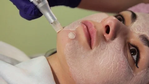 The young woman's face during the procedure closeup. Innovative cosmetic Stock Footage 83621713