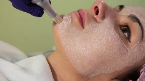 The young woman's face during the procedure closeup. Innovative cosmetic Stock Footage 83621886