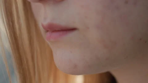 Youthful face with soft lighting. Closeup shot highlighting teenage facial Stock Footage 331736067