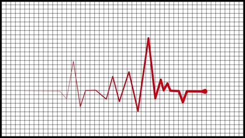 Zigzag line sharp rise and fall suggesting data heart rhythm wave pulse ani.. Stock Footage 337181977
