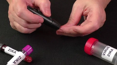 Zika virus concept footage with test tube on black background 스톡 동영상 59883742