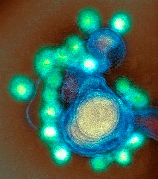 Zika virus particles, TEM Stock Photos