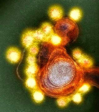 Zika virus particles, TEM 스톡 사진