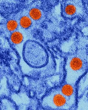 Zika virus, TEM 스톡 사진