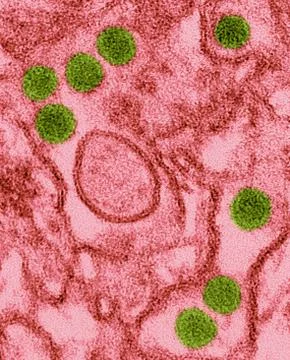 Zika virus, TEM Foto stock