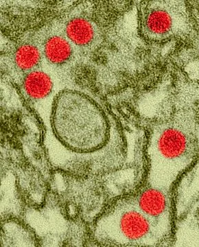 Zika virus, TEM Foto stock