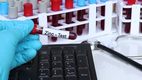 Zinc test, blood sample to analyze in the laboratory Stock Footage 239625569