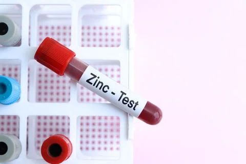 Zinc test, blood sample to analyze in the laboratory 스톡 사진
