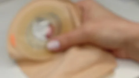 Zoom in colostomy bag, supply needed after colostomy surgery. Stoma pouch Stock Footage 122108243