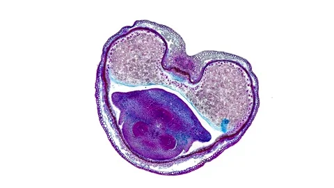 Zoom in cross section cut slice of plant stem under the microscope Stock Footage 171849445