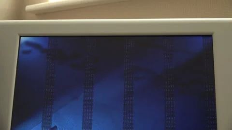 Zoom in to possible computer virus on screen Stock Footage 42219302