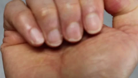 Zoom-in video of cracked nails Stock Footage 324549059