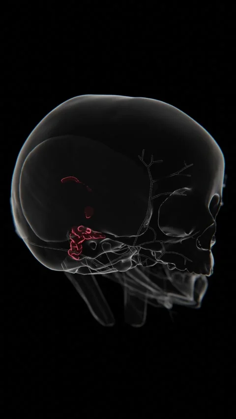 Zygomatic Abscess indication video in Vertical format | Zygomatic Abscess Stock Footage 322873617